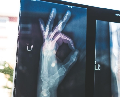 dobry ortopeda warszawa